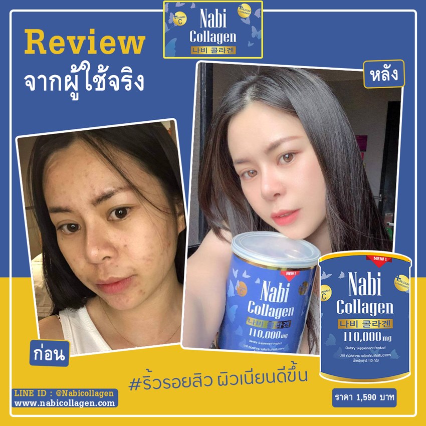 รีวิวคอลลาเจน