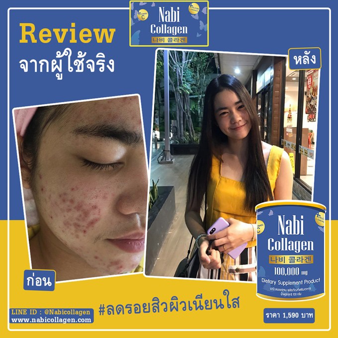 review Nabi Collagen ดีจริงไหม